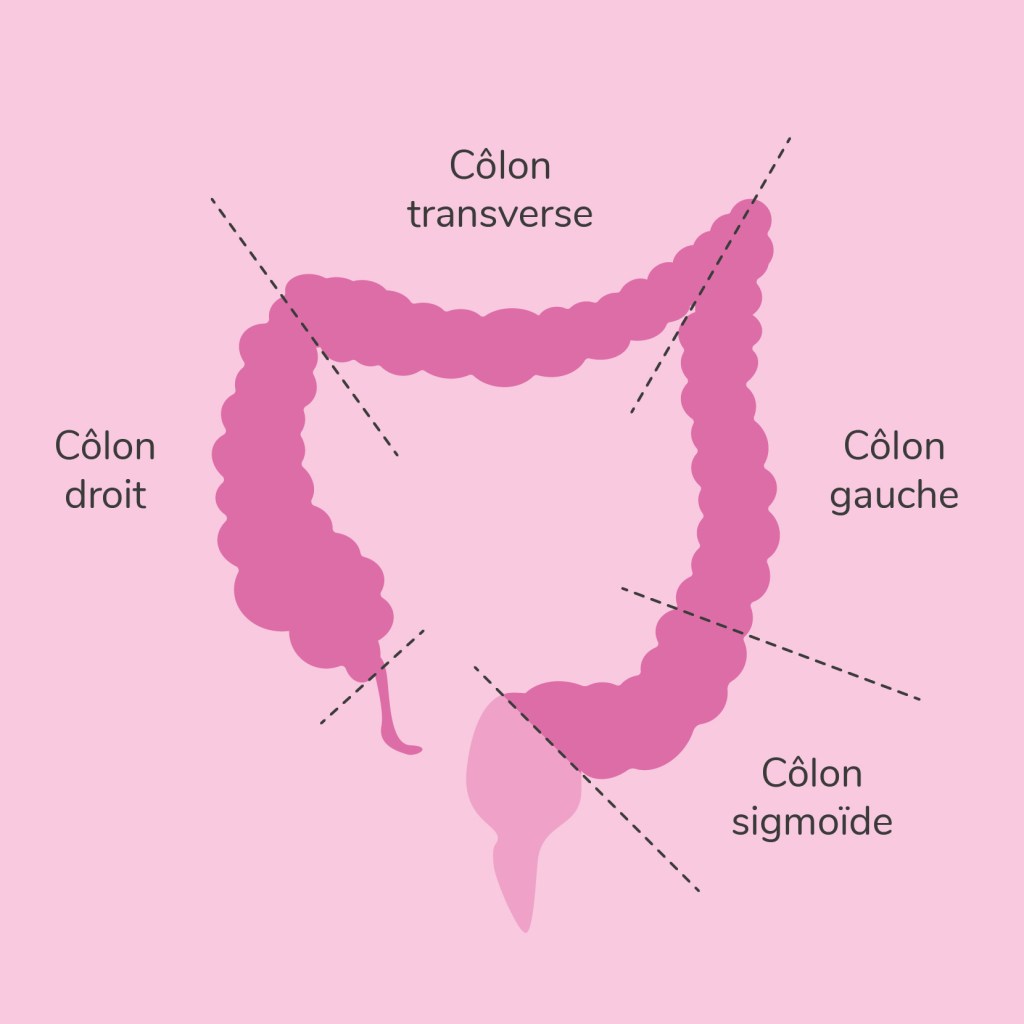 Mécanismes des cancers colorectaux (forme héréditaire, sporadique ...